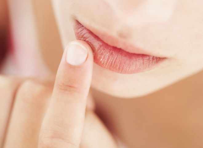 Сухость и шелушение губ