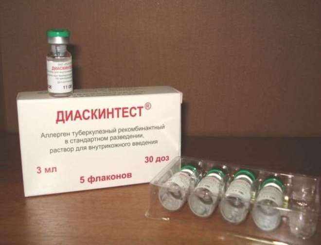 Диаскинтест
