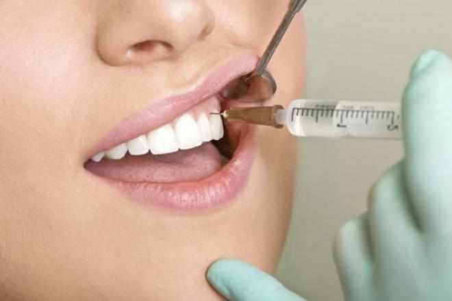 Обезболивающие уколы при лечении зубов