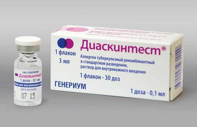 Диаскинтест