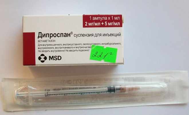 Дипроспан