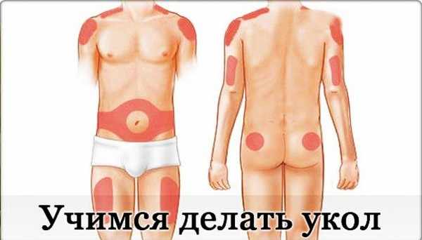 Места для уколов
