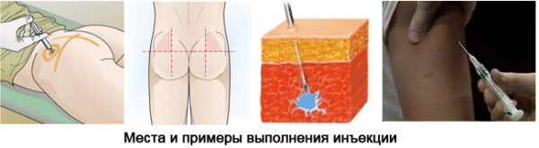 Амелотекс