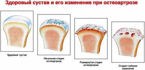 Амелотекс