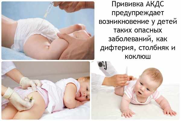Прививка АКДС детям