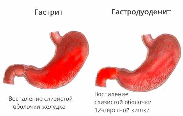 Витамины В12