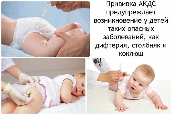 Прививка акдс