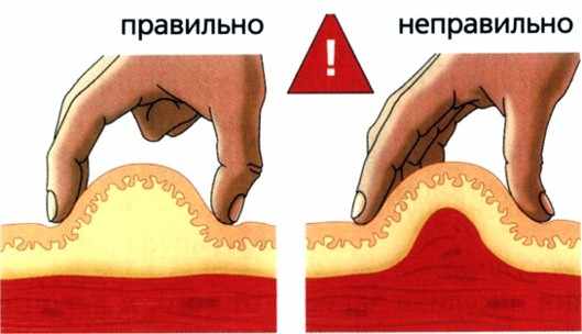 Место укола