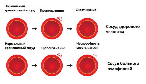 Хаврикс (вакцина)