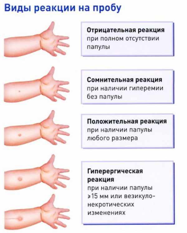 Размеры Манту