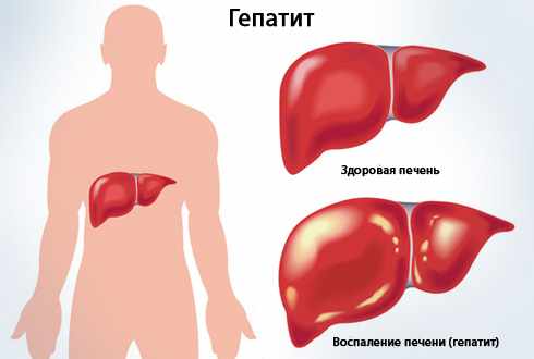 Энджерикс (вакцина)