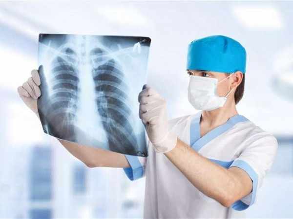 рентген на туберкулез