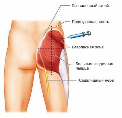 Энджерикс (вакцина)