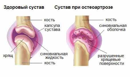 алфлутоп уколы