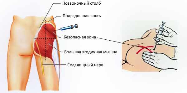 Простакор (уколы): инструкция по применению