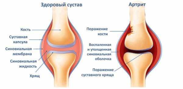 уколы дона