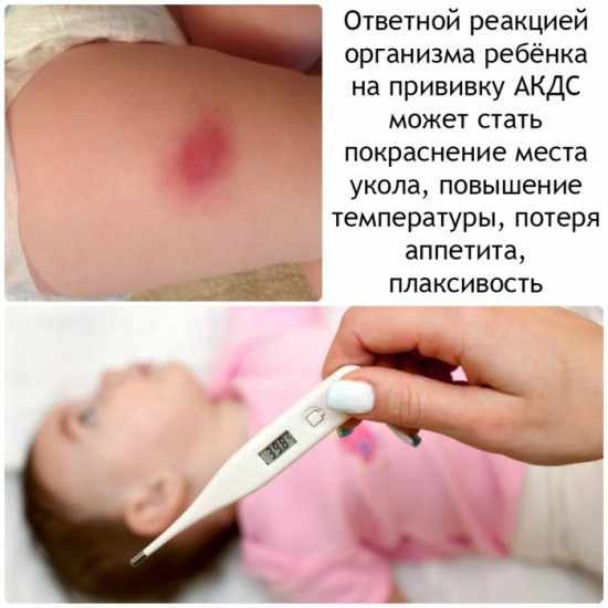 Реакция на АКДС