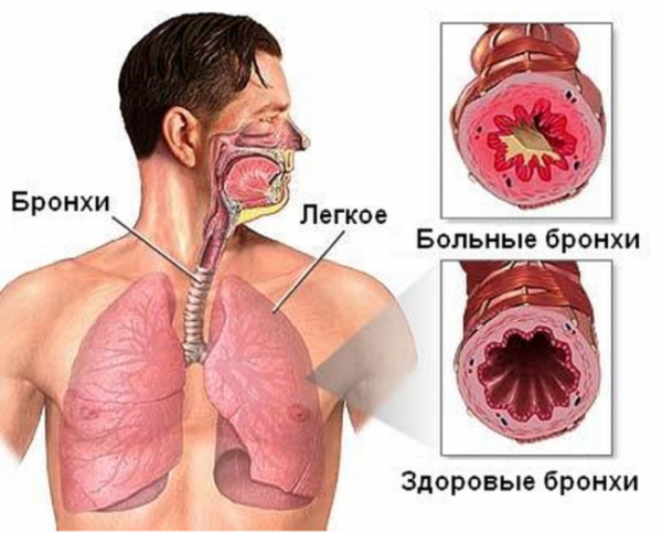 цефтриаксон инструкция по применению уколы