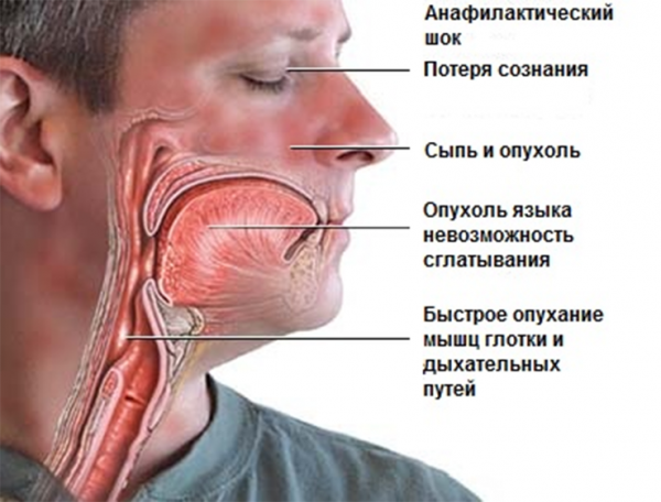 тавегил уколы