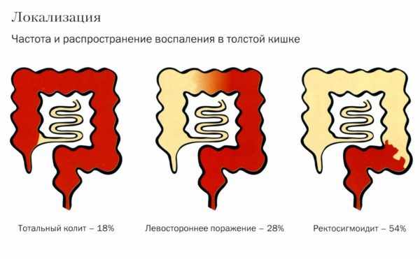 кеналог инструкция по применению уколы