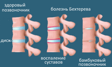 Лидаза уколы