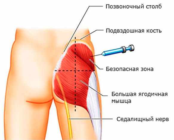 фотаксим инструкция по применению уколы