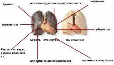 Влияние табака на легкие