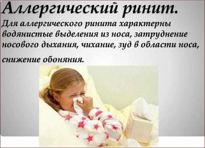 Симптомы аллергического ринита.
