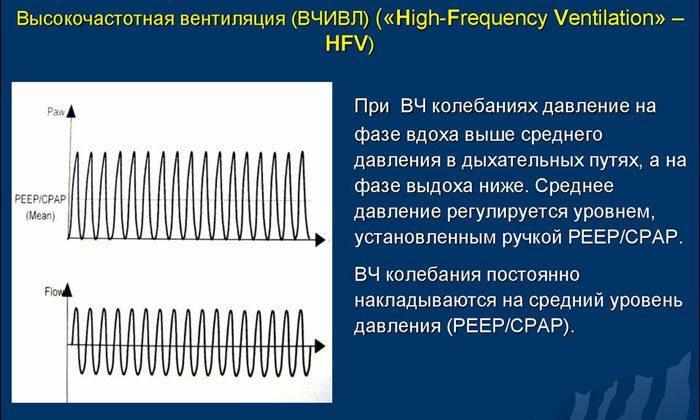 Высокочастотная вентиляция легких