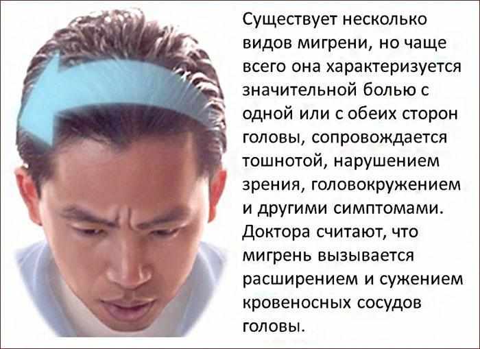 симптомы мигрени