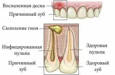 Образование флюса