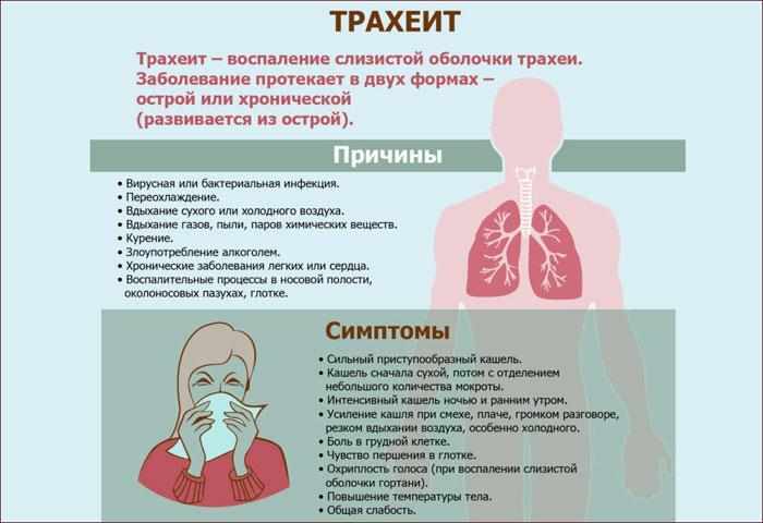 причины и симптомы трахеита