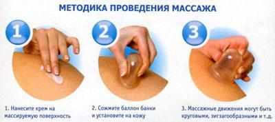 Вакуумный массаж