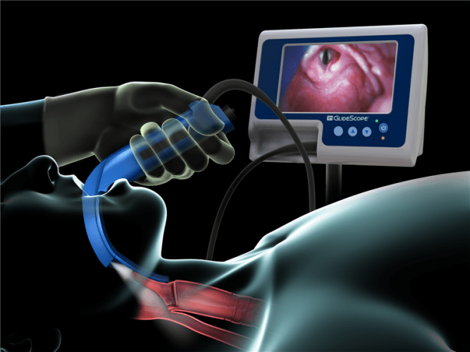 Фарингоскопия