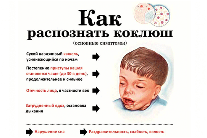 симптомы коклюша