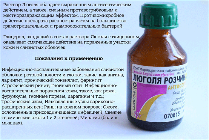 показания к применению раствора люголя