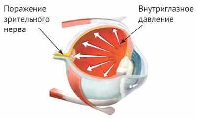 Глазное давление