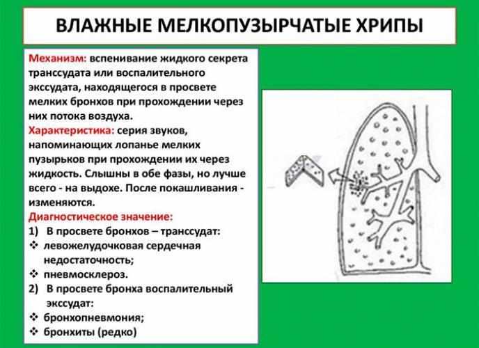 Диагностика влажных мелкопузырчатых хрипов