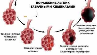 Поражение альвеол при курении