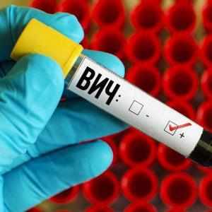 ВИЧ