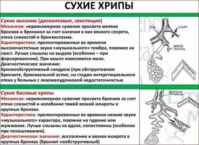 Диагностика сухих хрипов