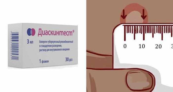 Как сделать диаскинтест