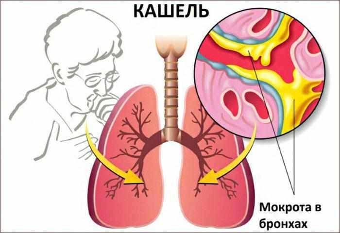 влажный кашель