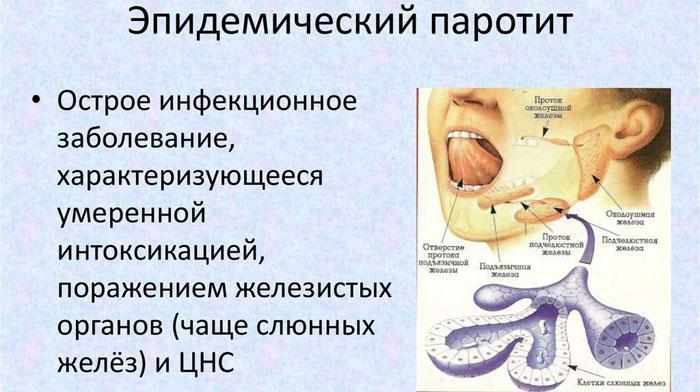 Симптомы эпидемического паротита