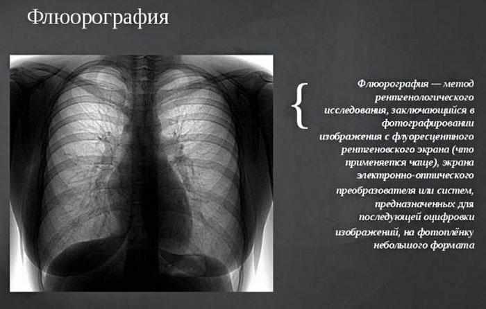 что такое флюорография
