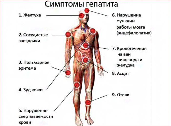 симптомы гепатита