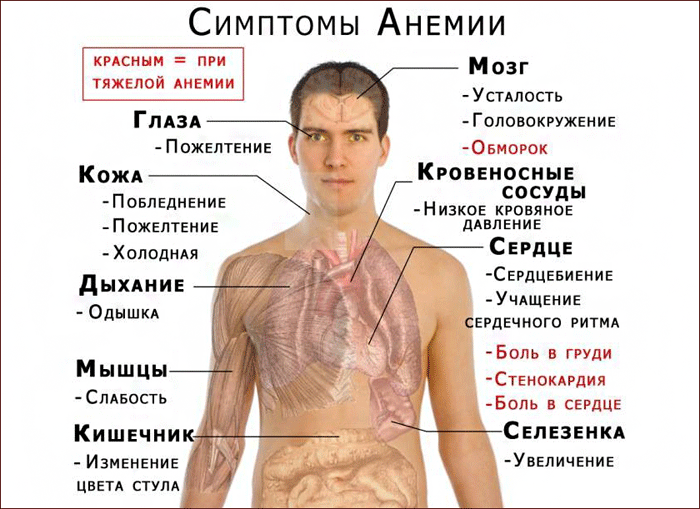 симптомы анемии