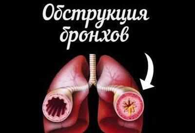 Обструкция бронхов