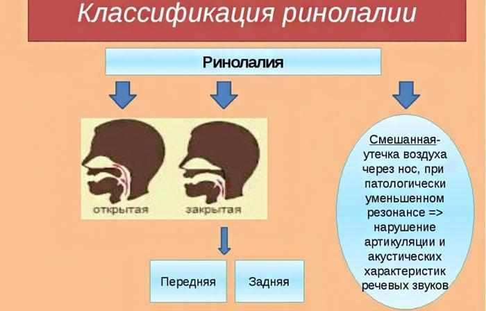 Классификация ринолалии