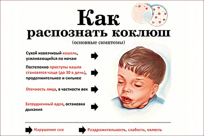 симптомы коклюша